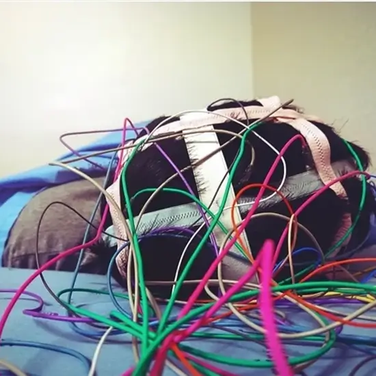 autoimmune encephalitis antibody test